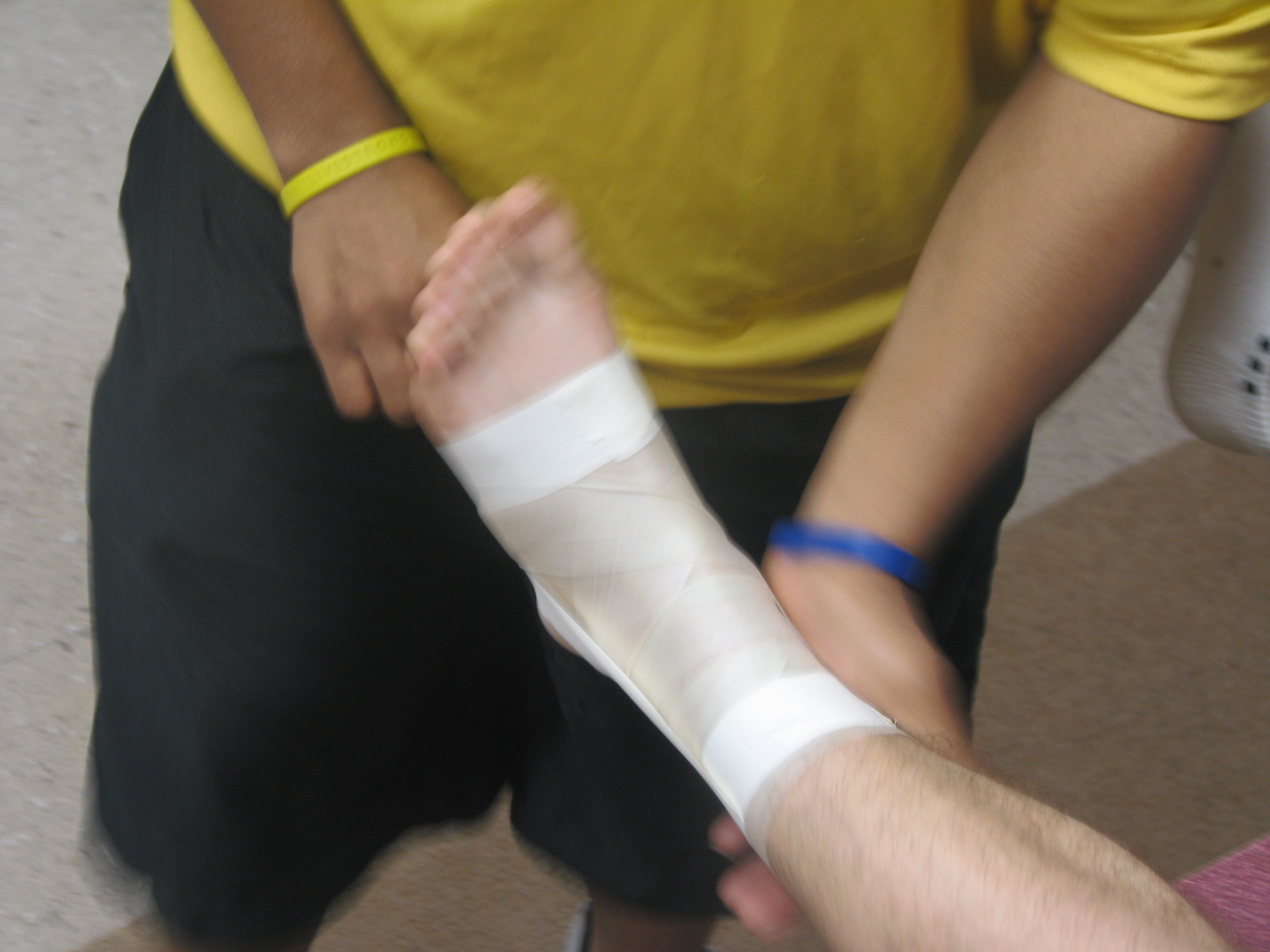 Taping an Ankle