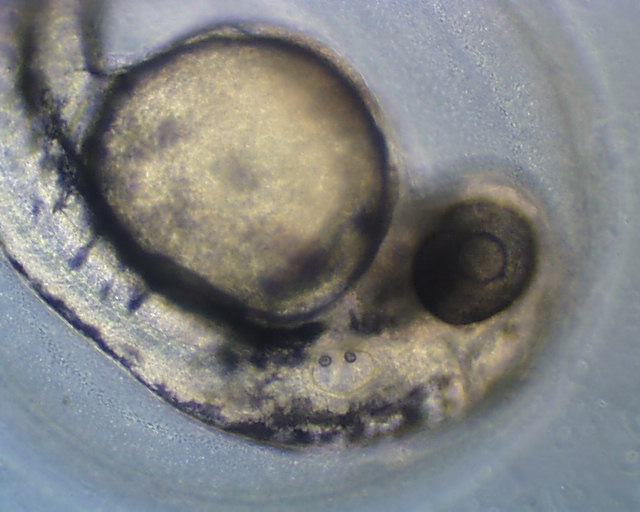 Zebra Fish Embryo in Egg Pics4Learning