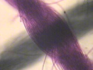 Crossed threads under microscope | Pics4Learning